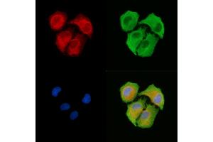 ABIN6263377 and ABIN6278723 staining  cells by IF/ICC.