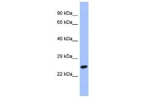WB Suggested Anti-DRAP1 Antibody Titration: 0. (DRAP1 antibody  (N-Term))