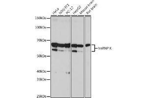 Western blot analysis of extracts of various cell lines, using hnRNP K antibody (ABIN7267634) at 1:2000 dilution. (HNRNPK antibody)