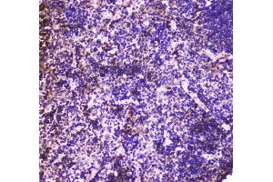 IHC analysis of Annexin VI using anti-Annexin VI antibody . (ANXA6 antibody  (AA 395-665))