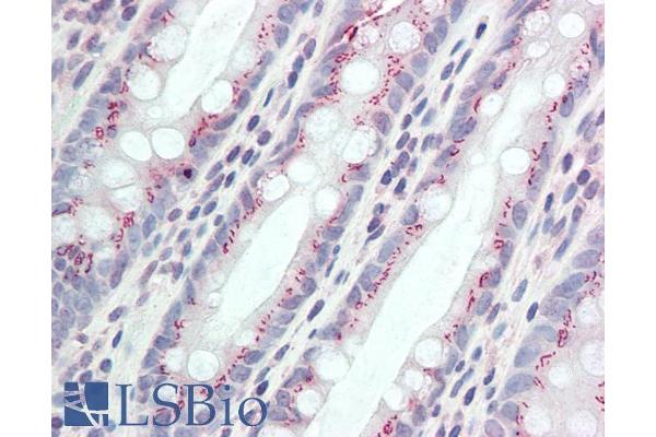 CCDC3 antibody  (AA 134-148)