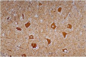 Immunohistochemistry of paraffin-embedded sections (human cerebellum) Immunohistochemistry staining of human cerebellum (paraffin-embedded sections) with anti-Neurofilament heavy protein (NF-01). (NEFH antibody)