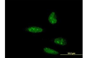 Immunofluorescence of monoclonal antibody to ATOH1 on HeLa cell. (ATOH1 antibody  (AA 266-354))