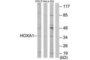 Western Blotting (WB) image for anti-Homeobox A1 (HOXA1) (AA 171-220) antibody (ABIN2889490) (HOXA1 antibody  (AA 171-220))