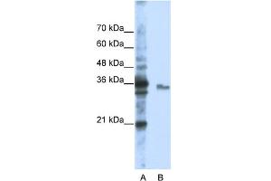 WB Suggested Anti-EXOSC3 Antibody Titration:  0. (EXOSC3 antibody  (Middle Region))