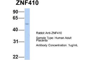 Host: Rabbit Target Name: ZNF410 Sample Type: Human Adult Placenta Antibody Dilution: 1. (ZNF410 antibody  (N-Term))