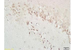 Formalin-fixed and paraffin embedded: rat brain tissue labeled with Anti-GABRB1 Polyclonal Antibody (ABIN669756), Unconjugated at 1:200 followed by conjugation to the secondary antibody and DAB staining
