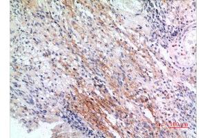 Immunohistochemistry (IHC) analysis of paraffin-embedded Human Brain, antibody was diluted at 1:100. (IFITM1 antibody  (N-Term))