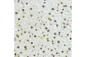 Immunohistochemistry of paraffin-embedded rat liver using Phospho-Histone H3-S10/T11 antibody (ABIN7267688) at dilution of 1:100 (40x lens). (Histone 3 antibody  (H3S10p, H3T11p))