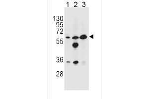 GATM Antibody (N-term) (ABIN654401 and ABIN2844143) western blot analysis in HL-60(lane 1),MDA-M(lane 2),K562(lane 3) cell line lysates (35 μg/lane). (GATM antibody  (N-Term))