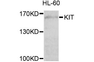 Western blot analysis of extracts of HL-60 cells, using KIT antibody (ABIN6003494) at 1/1000 dilution. (KIT antibody)