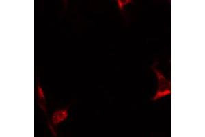 ABIN6267637 staining HepG2 by IF/ICC. (BIK antibody  (pThr33))