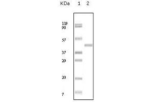 Western Blot showing ABL2 antibody used against truncated ABL2 recombinant protein. (ABL2 antibody)