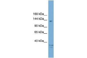 WB Suggested Anti-ARID5B  Antibody Titration: 0.