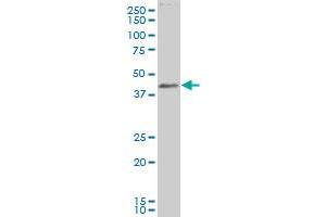 LASS6 polyclonal antibody (A01), Lot # 061229JCSa Western Blot analysis of LASS6 expression in IMR-32 (CERS6 antibody  (AA 62-131))