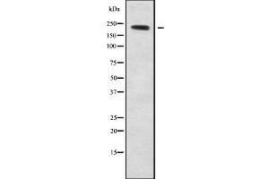 Western blot analysis NAV1 using COS7 whole cell lysates (NAV1 antibody)