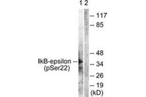 Western blot analysis of extracts from Jurkat cells treated with TNF-a 20ng/ml 30', using IkappaB-epsilon (Phospho-Ser22) Antibody. (IkappaB-epsilon antibody  (pSer22))
