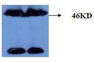Western Blotting (WB) image for anti-Microtubule-Associated Protein tau (MAPT) (AA 177-187), (pThr181) antibody (ABIN1108153) (MAPT antibody  (pThr181))