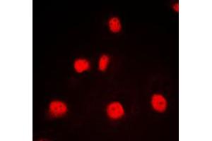 Immunofluorescent analysis of GATA1 staining in K562 cells. (GATA1 antibody  (Center))