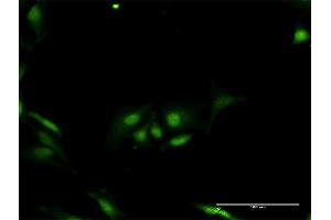 Immunofluorescence of purified MaxPab antibody to ORC6L on HeLa cell. (ORC6 antibody  (AA 1-252))