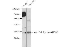 Western blot analysis of extracts of various cell lines, using Mast Cell Tryptase (Mast Cell Tryptase (TPSB2)) antibody (ABIN7271018) at 1:1000 dilution. (TPSB2 antibody  (AA 1-275))