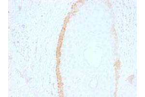 Immunohistochemical staining (Formalin-fixed paraffin-embedded sections) of human skin with KRT15 monoclonal antibody, clone SPM190 .