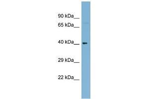 WB Suggested Anti-C1orf92 Antibody Titration: 0. (C1orf92 antibody  (Middle Region))