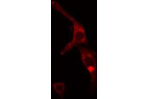 ABIN6272441 staining MCF7 cells by IF/ICC. (TBL2 antibody  (C-Term))