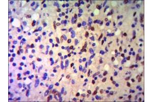 Immunohistochemistry (IHC) image for anti-Tripartite Motif Containing 28 (TRIM28) antibody (ABIN6241957)