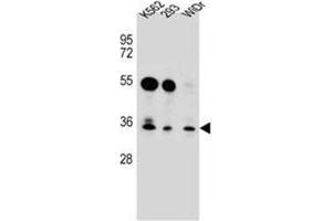 Western blot analysis of GLIPR1L2 Antibody (N-term) in K562,293,WiDr cell line lysates (35ug/lane). (GLIPR1L2 antibody  (N-Term))
