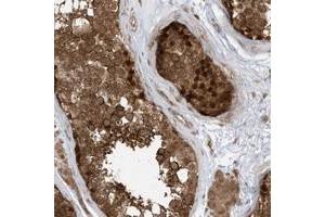 Immunohistochemical staining of human testis with DHX36 polyclonal antibody  shows strong nuclear and cytoplasmic positivity in cells of seminiferus ducts at 1:20-1:50 dilution.