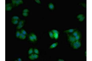 Immunofluorescent analysis of HepG2 cells using ABIN7175485 at dilution of 1:100 and Alexa Fluor 488-congugated AffiniPure Goat Anti-Rabbit IgG(H+L) (VAMP7 antibody  (AA 2-186))