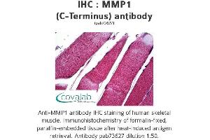 Image no. 1 for anti-Matrix Metallopeptidase 1 (Interstitial Collagenase) (MMP1) (C-Term) antibody (ABIN1737001) (MMP1 antibody  (C-Term))
