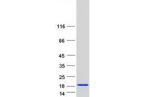 Validation with Western Blot (PFDN1 Protein (Myc-DYKDDDDK Tag))