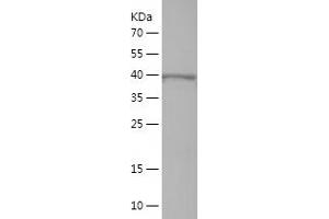 Western Blotting (WB) image for Interleukin 17 Receptor B (IL17RB) (AA 317-494) protein (His-IF2DI Tag) (ABIN7283972) (IL17 Receptor B Protein (AA 317-494) (His-IF2DI Tag))