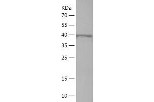 IL17 Receptor B Protein (AA 317-494) (His-IF2DI Tag)