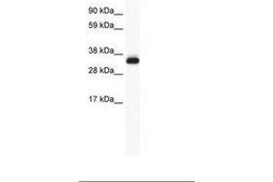 Image no. 1 for anti-Annexin A5 (ANXA5) (AA 93-142) antibody (ABIN202232) (Annexin V antibody  (AA 93-142))