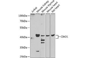 Western blot analysis of extracts of various cell lines, using CI antibody (ABIN6130236, ABIN6138617, ABIN6138618 and ABIN6223206) at 1:1000 dilution. (CIAO1 antibody  (AA 1-339))