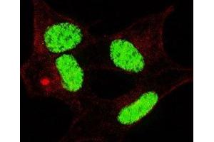 Fluorescent confocal image of SY5Y cells stained with phospho-LIN28 antibody.
