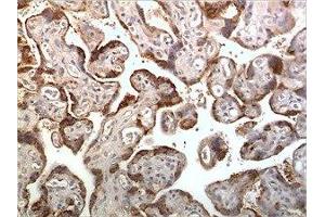 Immunohistochemistry (IHC) image for anti-Chemokine (C-X-C Motif) Receptor 2 (CXCR2) (AA 1-355) antibody (ABIN1889549) (CXCR2 antibody  (AA 1-355))