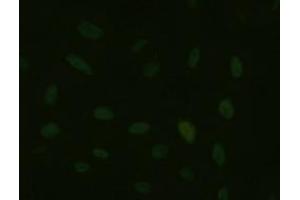 Immunofluorescent staining of HeLa cells using anti-HNF6 mouse monoclonal antibody (ABIN2452681).