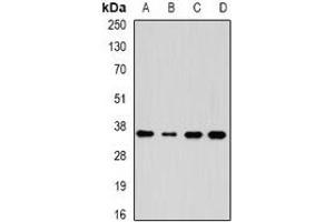 Western blot analysis of AKR7A3 expression in HepG2 (A), HT29 (B), mouse kidney (C), mouse liver (D) whole cell lysates. (AKR7A3 antibody)