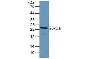 Figure. (PDCD6 antibody  (AA 32-191))