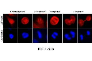 ICC/IF analysis of human HeLa cells stained with Hoechst 3342 (Blue) for chromatin staining and monoclonal anti-human Aurora kinase B antibody (1:2000) with Texas Red (Red). (Aurora Kinase B antibody  (AA 1-344))