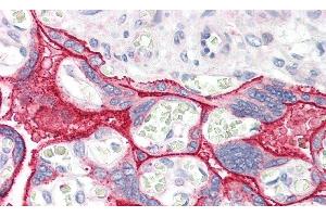 Detection of CCK in Human Placenta Tissue using Polyclonal Antibody to Cholecystokinin (CCK) (Cholecystokinin antibody  (AA 1-115))
