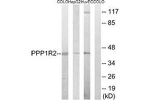Western blot analysis of extracts from HuvEc/HepG2/COLO cells, using PPP1R2 (Ab-44) Antibody. (PPP1R2 antibody  (AA 10-59))