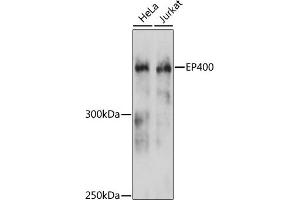 Western blot analysis of extracts of various cell lines, using EP400 antibody (ABIN6127822, ABIN6140195, ABIN6140196 and ABIN6215738) at 1:3000 dilution. (EP400 antibody  (AA 90-330))