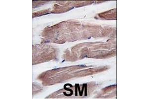 Formalin-fixed and paraffin-embedded human skeletal muscle tissue reacted with hPI3KC3 (N-term) (ABIN1882112 and ABIN2849998) , which was peroxidase-conjugated to the secondary antibody, followed by DAB staining. (PIK3C3 antibody  (N-Term))
