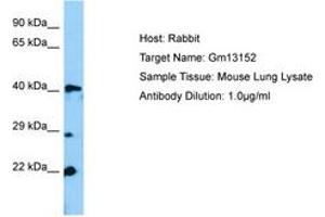 Image no. 1 for anti-Zinc Finger Protein 982 (Zfp982) (N-Term) antibody (ABIN6749822) (Zfp982 antibody  (N-Term))
