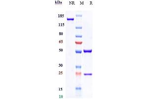 anti-GPNMB (Glembatumumab Biosimilar) antibody